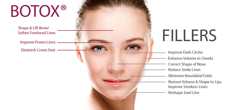 BOTOX