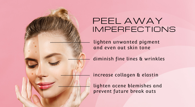 CHEMICAL PEELS