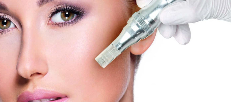Micro-Needling