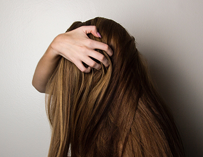 HAIR LOSS 