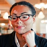 VITILIGO